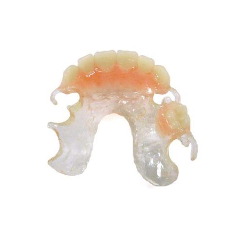 Clearmet partial case #1