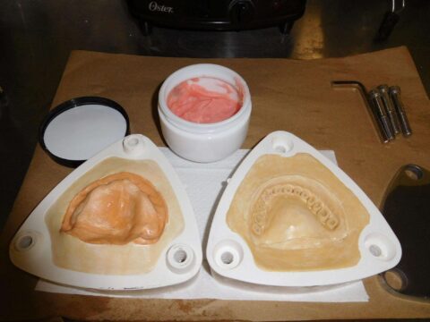 Efficiency and Accuracy in Denture Base Processing - Figure 10
