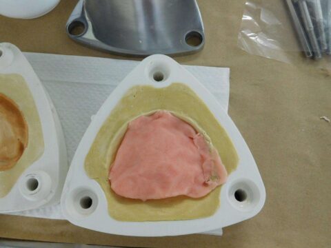 Efficiency and Accuracy in Denture Base Processing - Figure 11