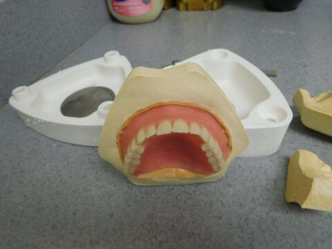 Efficiency and Accuracy in Denture Base Processing - Figure 16