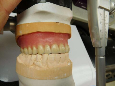 Efficiency and Accuracy in Denture Base Processing - Figure 17