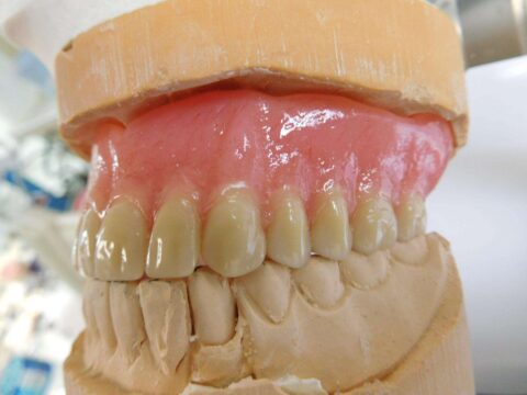 Efficiency and Accuracy in Denture Base Processing - Figure 18