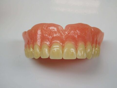 Efficiency and Accuracy in Denture Base Processing - Figure 19