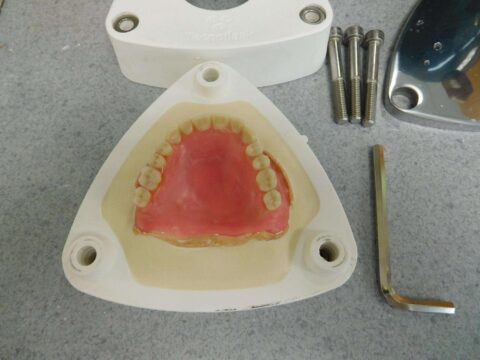 Efficiency and Accuracy in Denture Base Processing - Figure 3