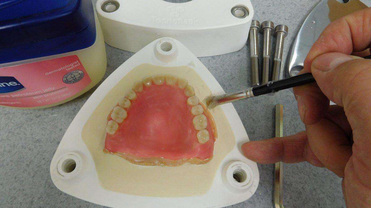 Efficiency and Accuracy in Denture Base Processing