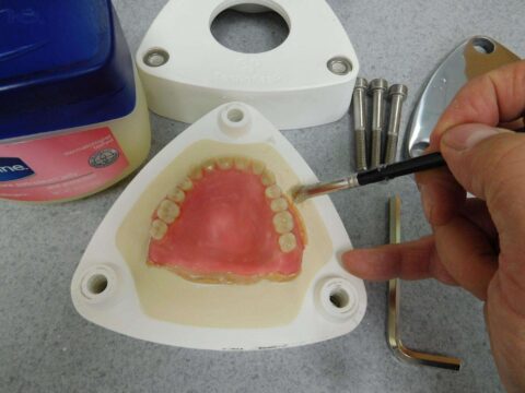 Efficiency and Accuracy in Denture Base Processing - Figure 4