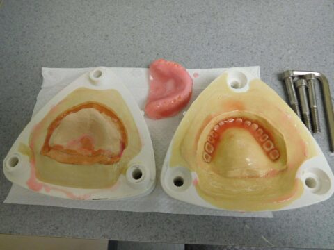 Efficiency and Accuracy in Denture Base Processing - Figure 8