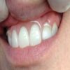 Itsoclear Clasps