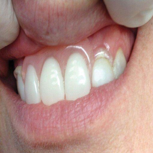 Itsoclear Clasps