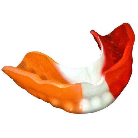 Pro-Form Mouthguard Tri-Color Laminates