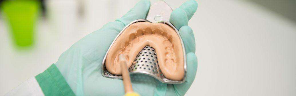 Product Category: Impression Trays