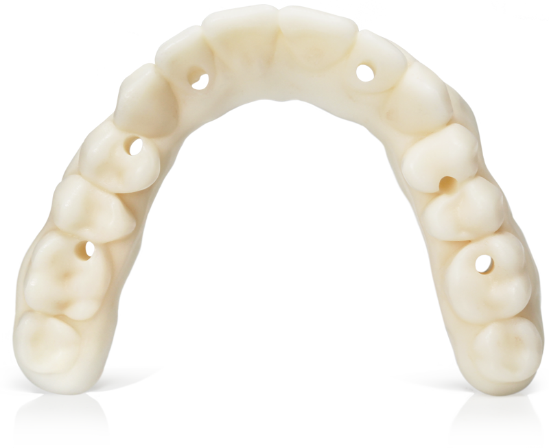 KeyDenture Try-In