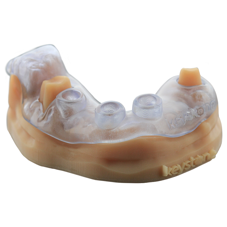 KeyGuide surgical guide resin