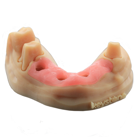 KeyMask gingival mask resin